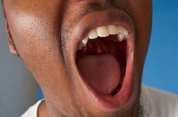 Bad Breath